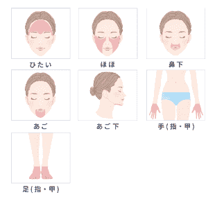 Sパーツの画像