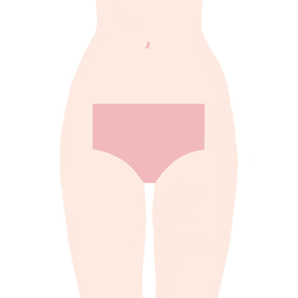 VIOの脱毛箇所の画像